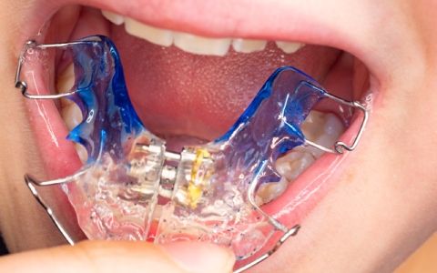 Techniques orthodontiques