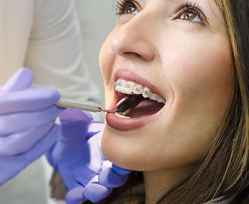 orthodontie adulte orthodontie adulte