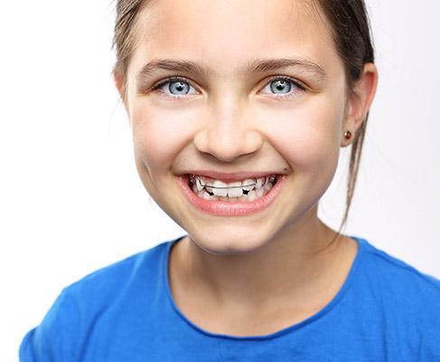 traitements d'orthodontie précoces