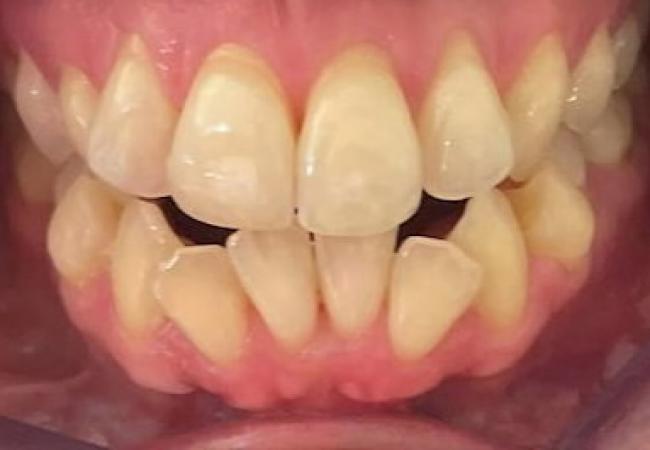 Traitement des cas orthodontiques chirurgicaux par Guy Baeten Spécialiste en Orthodontie