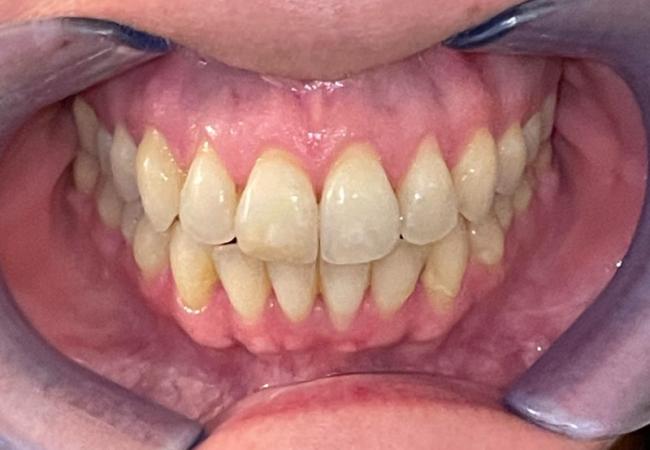 Traitement des cas orthodontiques chirurgicaux par Guy Baeten Spécialiste en Orthodontie